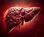 Study links low levels of PM2.5 exposure to liver damage