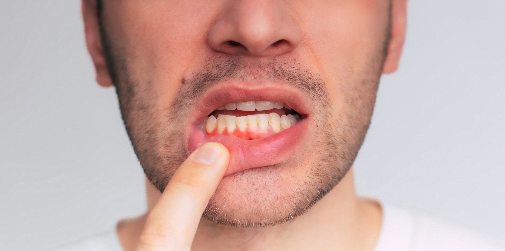 Study: The impact of e-cigarette use on periodontal health: a systematic review and meta-analysis. Image Credit: My Ocean Production / Shutterstock