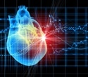 Sweat fails to match blood in tracking inflammation after heart attacks