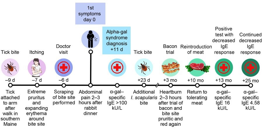 Timeline of symptom onset in a patient with alpha-gal syndrome after Ixodes scapularis tick bite, Maine, USA, 2022.