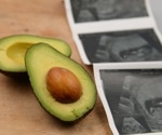 Eating avocado in pregnancy cuts infant food allergy risk by nearly half