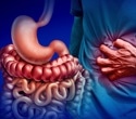 Can diet ease IBS? A low-FODMAP plan cut symptoms but raised nutrient concerns