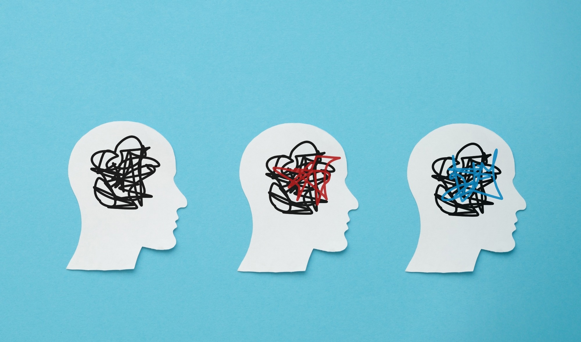 Study: Association between ADHD symptoms, physical effort discounting, and unhealthy lifestyles in adults. Image Credit: Inna Kot / Shutterstock