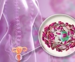 Vaginal microbiome fights back against stubborn BV infections