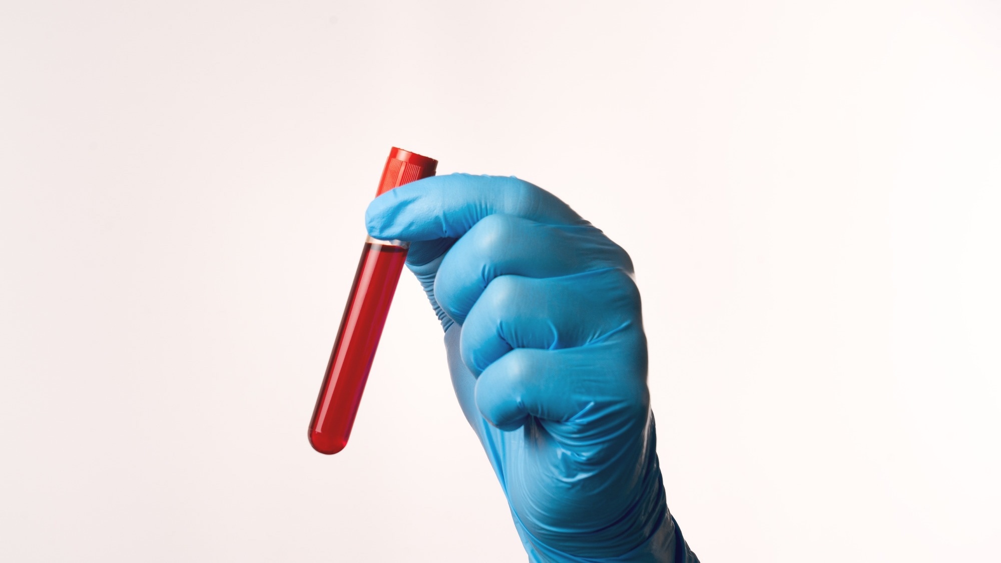 Study: Plasma proteomics links brain and immune system aging with healthspan and longevity. Image Credit: AntonSAN / Shutterstock