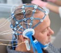 EEG ‘Fastball’ shows promise for spotting early memory loss in Alzheimer’s