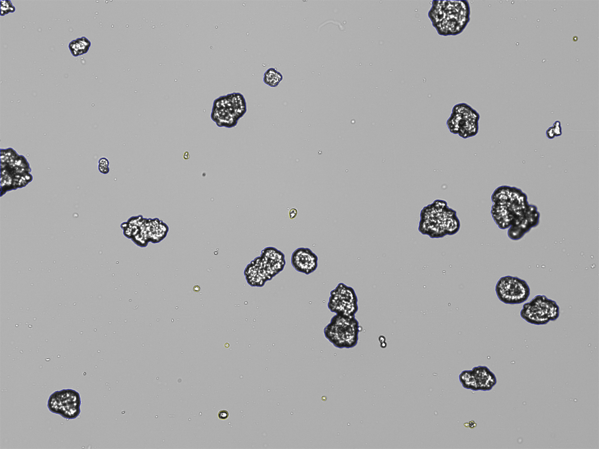 Organoids result image from the CellDrop FLi Automated Cell Counter.
