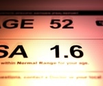 Study confirms PSA screening improves survival and safety