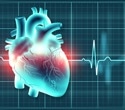 Study reveals the hidden toll of sudden cardiac death in type 1 and type 2 diabetes