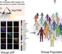 AI turns routine pathology slides into powerful maps of the tumor immune landscape