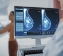 Low-dose megestrol strengthens hormone therapy in ER-positive breast cancer