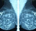 Study uncovers how aggressive breast cancer cells escape immune defenses