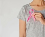 Researchers discover how aggressive breast cancer controls protein production