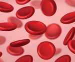 Repurposed Alzheimer’s medication offers low-cost hope for sickle cell anemia