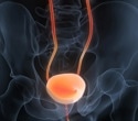 Cell Painting technology uncovers flavonoids with potential to treat bladder cancer