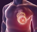 Cardiac MRI could help detect lamin heart disease