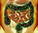 Gut bacteria compound during pregnancy protects offspring from fatty liver disease