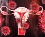 Study sheds light on endometriosis pain