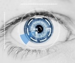 AI-based glaucoma screening could revolutionize eye health