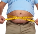 New medical database enhances obesity research and treatment